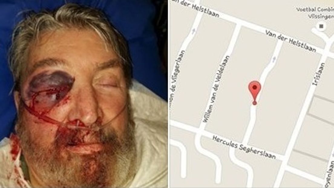 Man (69) zwaargewond na zinloos geweld